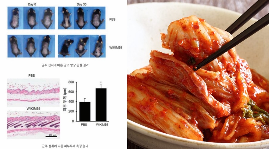 김치 유산균에서 '탈모 치료 성분' 발견