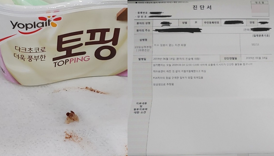 "요플레 먹다가 치아 파절됐다"는 소비자 항의에 업체 측 "이물질이 아니라 첨가물" 반박