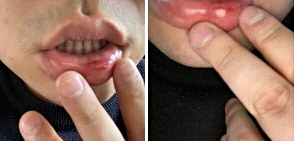 입술 터지게 맞은 20대 갑질손님에 "정신 번쩍 드냐" 사장 답글 화제